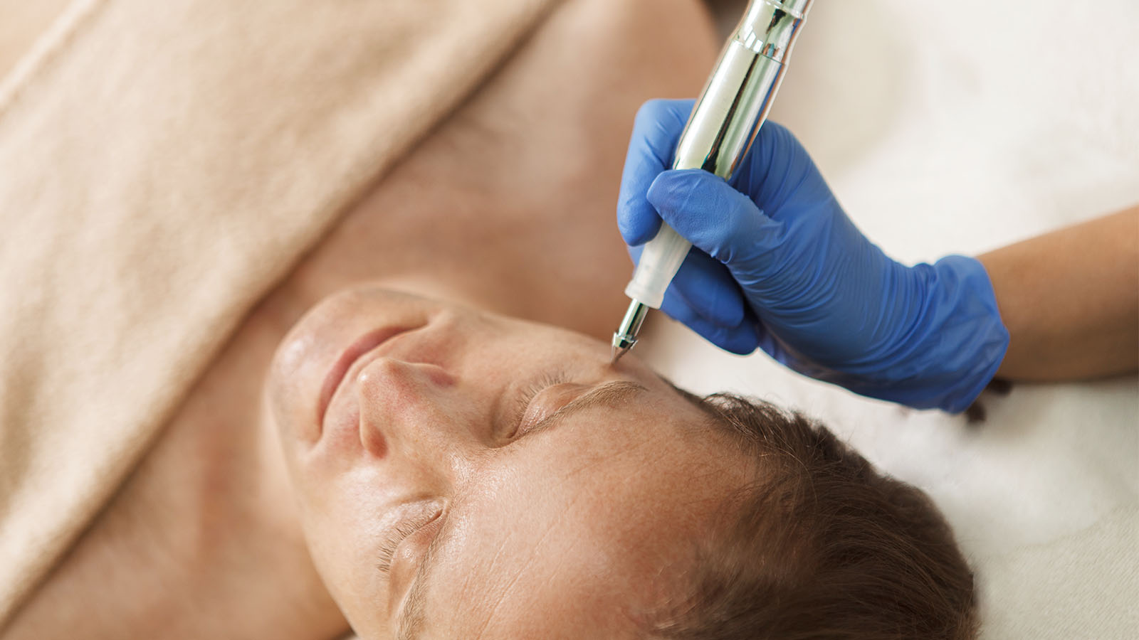 Coagulaci&oacute;n Facial para hombres en Men's Bodyland