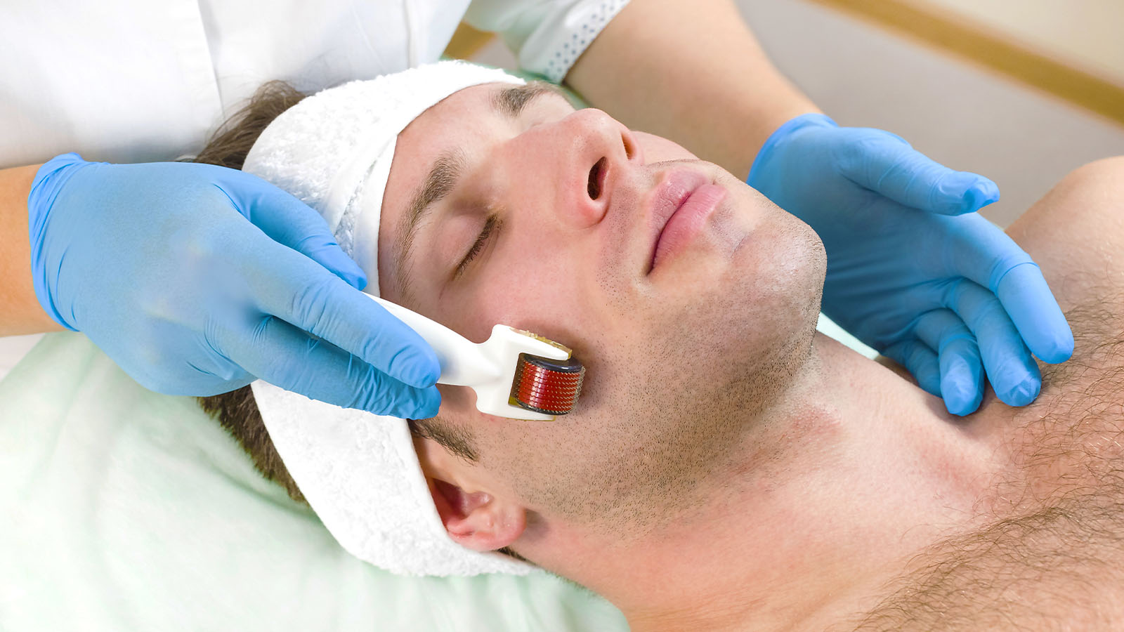 Micro Needling Facial para hombres en Men's Bodyland