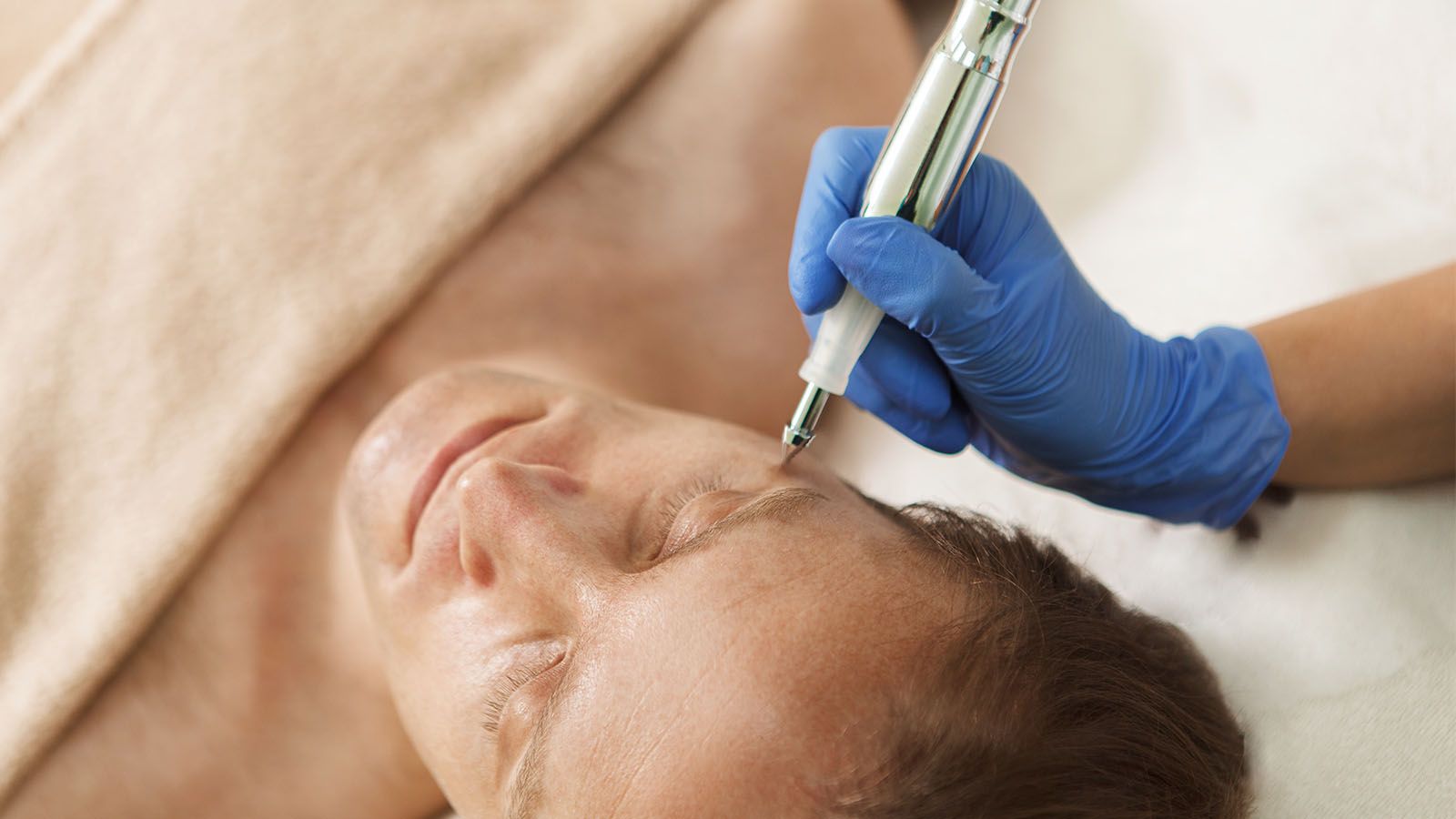 Coagulaci&oacute;n Facial para hombres en Men's Bodyland