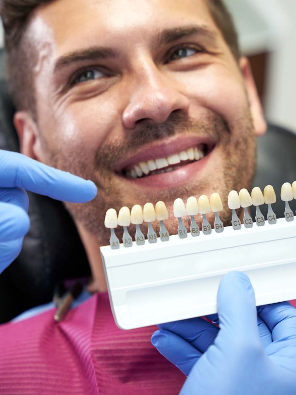 Men’s Bodyland Tanden Bleken